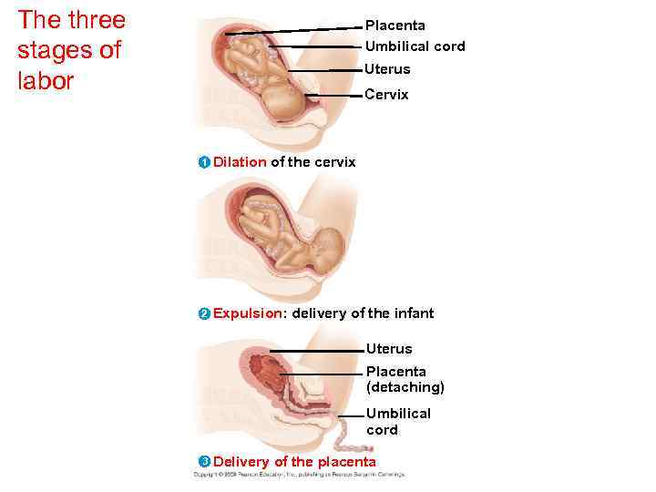 The three stages of labor Placenta Umbilical cord Uterus Cervix 1 Dilation of the