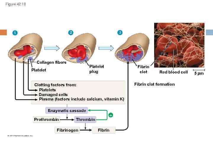 Figure 42. 18 2 1 3 Collagen fibers Platelet plug Platelet Fibrin clot Clotting