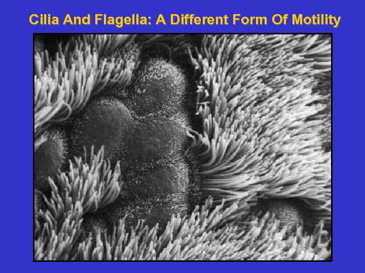 Cilia And Flagella: A Different Form Of Motility 
