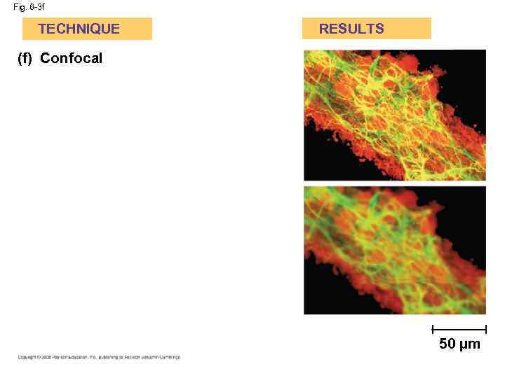 Fig. 6 -3 f TECHNIQUE RESULTS (f) Confocal 50 µm 