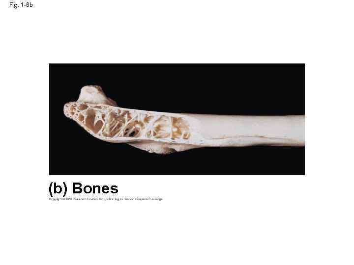 Fig. 1 -6 b (b) Bones 