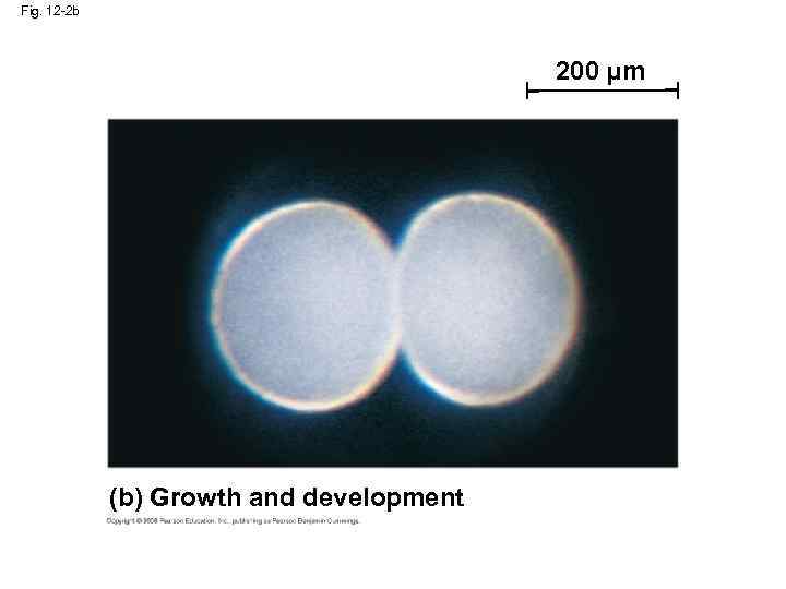 Fig. 12 -2 b 200 µm (b) Growth and development 