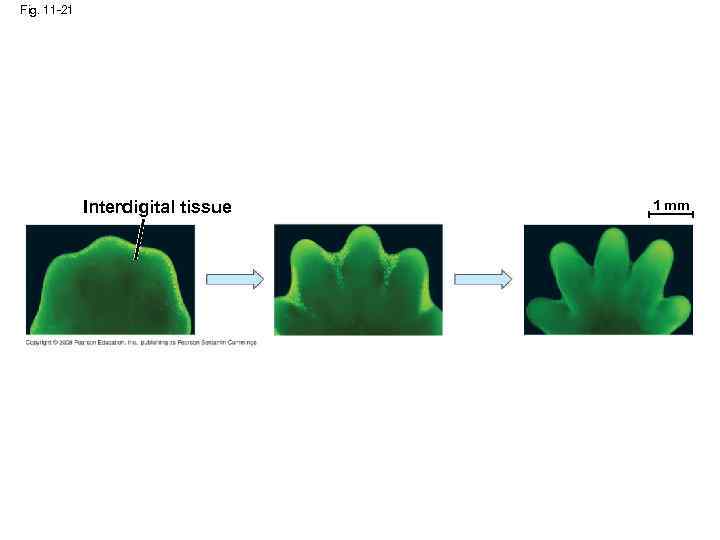 Fig. 11 -21 Interdigital tissue 1 mm 