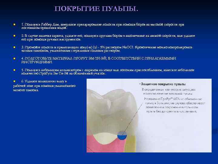 ПОКРЫТИЕ ПУЛЬПЫ. n 1. Пользуясь Раббер Дам, завершите препарирование полости при помощи боров на