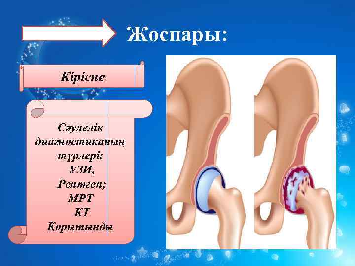 Жоспары: Кіріспе Сәулелік диагностиканың түрлері: УЗИ, Рентген; МРТ КТ Қорытынды 