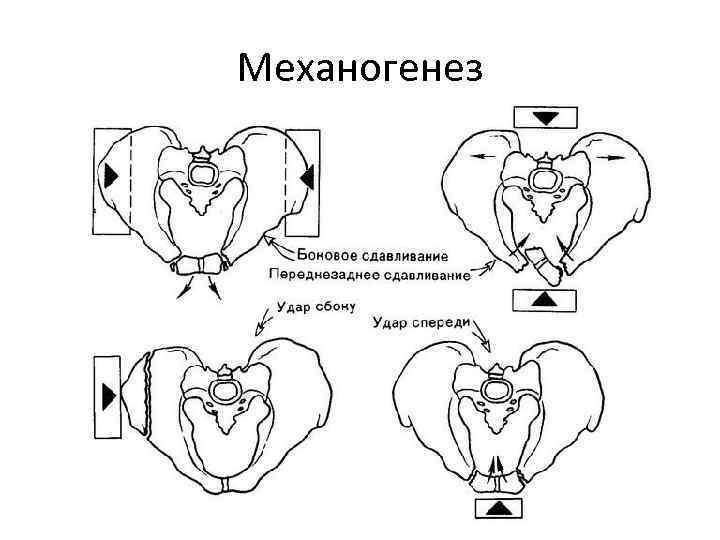 Механогенез 