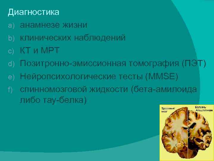 Диагностика a) анамнезе жизни b) клинических наблюдений c) КТ и МРТ d) Позитронно-эмиссионная томография