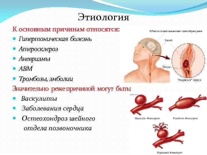 Аневризма шейного отдела