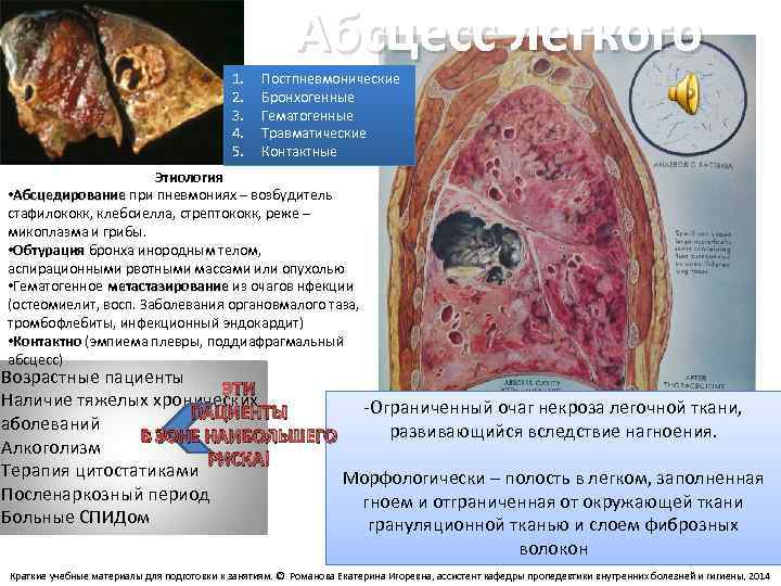 1. 2. 3. 4. 5. Абсцесс легкого Постпневмонические Бронхогенные Гематогенные Травматические Контактные Этиология •