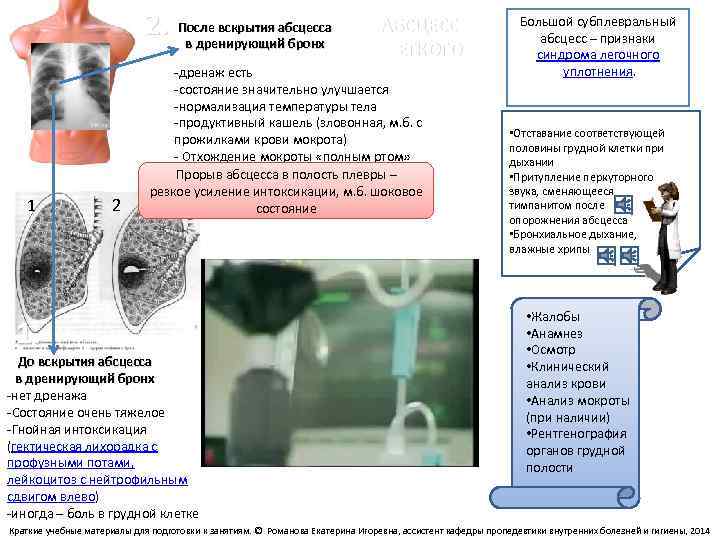 2. После вскрытия абсцесса в дренирующий бронх 1 1. 2 АБСЦЕСС ЛЕГКОГО -дренаж есть