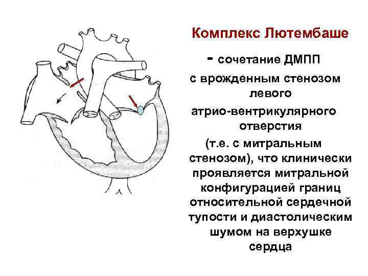 Пороки сердца факультетская терапия презентация