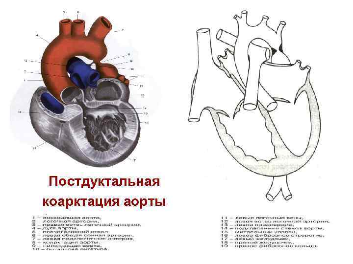 Пороки сердца факультетская терапия презентация