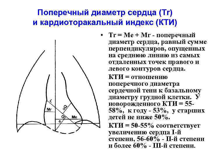 Поперечный диаметр