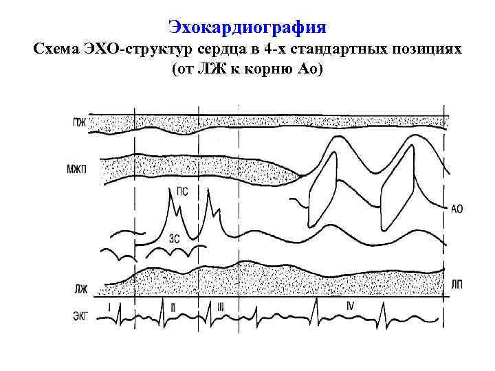 Эхокардиография в таблицах и схемах рыбакова митьков