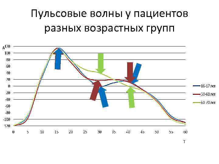 Пульсовые волны у пациентов разных возрастных групп 