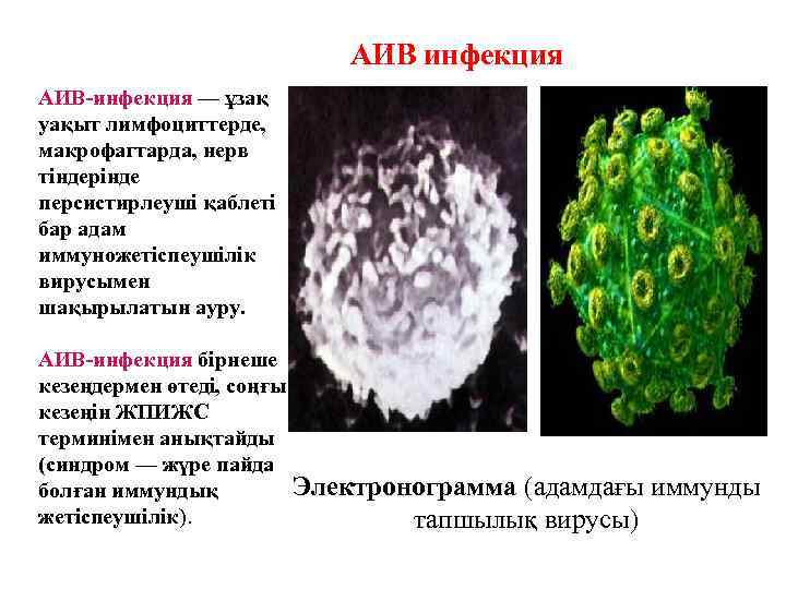 АИВ инфекция АИВ-инфекция — ұзақ уақыт лимфоциттерде, макрофагтарда, нерв тіндерінде персистирлеуші қаблеті бар адам