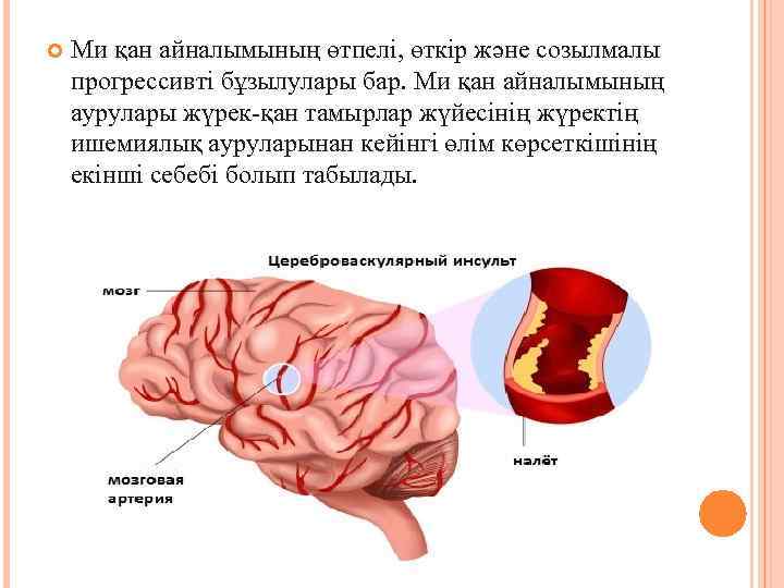  Ми қан айналымының өтпелі, өткір және созылмалы прогрессивті бұзылулары бар. Ми қан айналымының