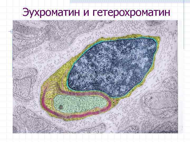 Эухроматин и гетерохроматин это. Эухроматин и гетерохроматин. Хроматин ЭУ И гетерохроматин. Ядрышко это гетерохроматин. Эухроматин рисунок.