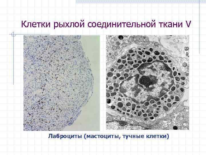 Клетки рыхлой соединительной ткани V Лаброциты (мастоциты, тучные клетки) 