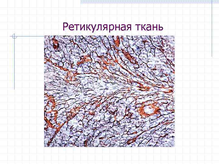 Ретикулярная ткань 