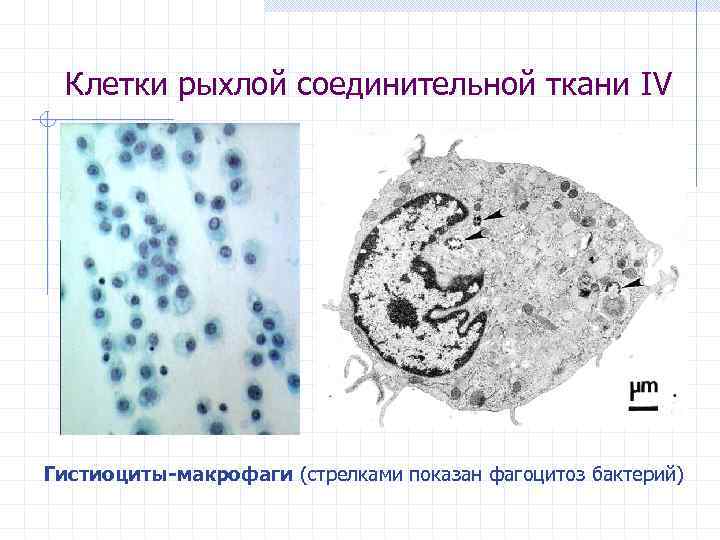 Клетки рыхлой соединительной ткани IV Гистиоциты-макрофаги (стрелками показан фагоцитоз бактерий) 