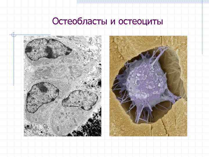 Остеобласты и остеоциты 