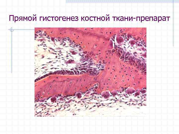 Прямой гистогенез костной ткани-препарат 