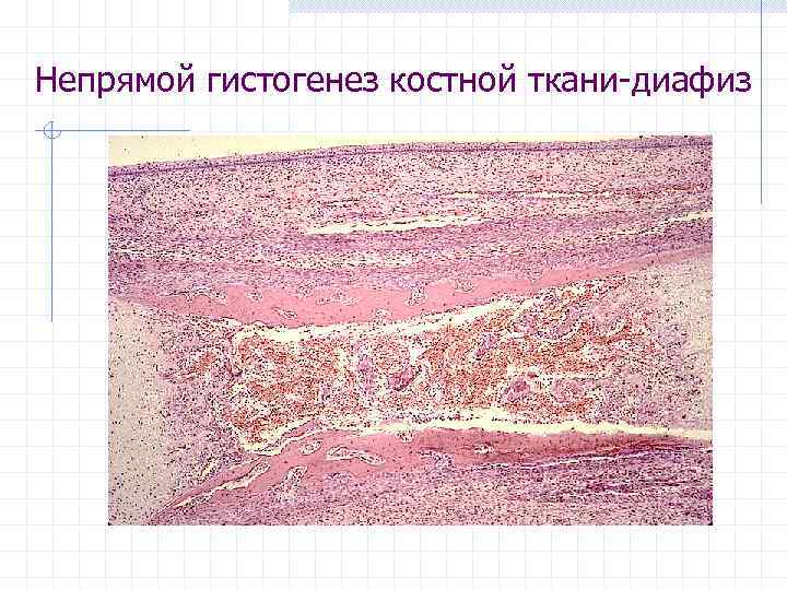 Непрямой гистогенез костной ткани-диафиз 