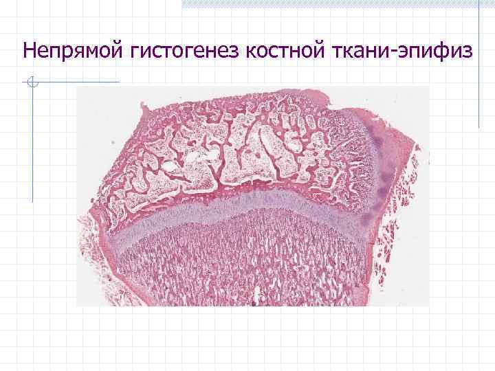 Непрямой гистогенез костной ткани-эпифиз 