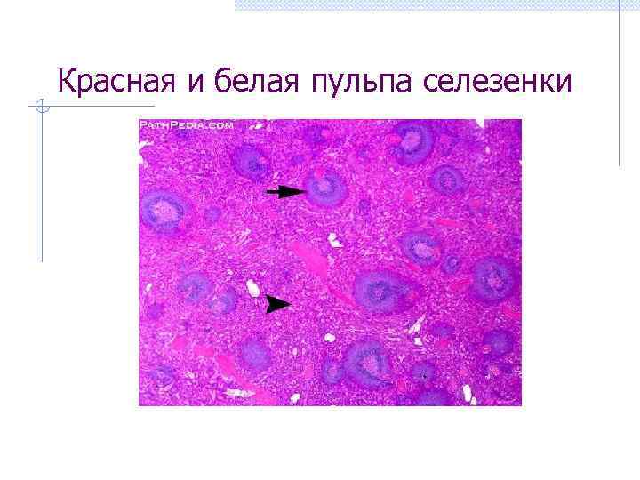 Красная и белая пульпа селезенки 