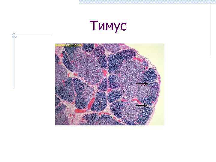 Тимус 