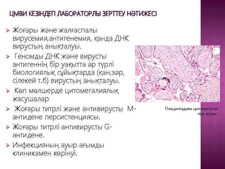 Цитомегаловирус иммуноглобулин. Цитомегаловирусный сиалоаденит микропрепарат. Цитомегаловирусныц малоаденит микро. Цитомегалический сиалоаденит патанатомия рисунок с обозначениями.