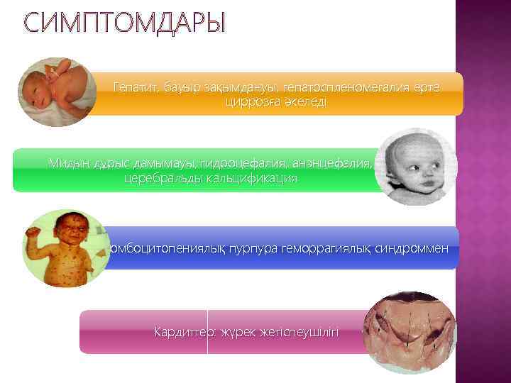 Гепатит, бауыр зақымдануы, гепатоспленомегалия ерте циррозға әкеледі Мидың дұрыс дамымауы, гидроцефалия, анэнцефалия, церебральды кальцификация