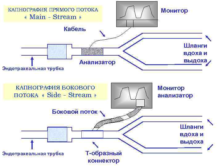 КАПНОГРАФИЯ ПРЯМОГО ПОТОКА « Main - Stream » Монитор Кабель Aнализатор Шланги вдоха и