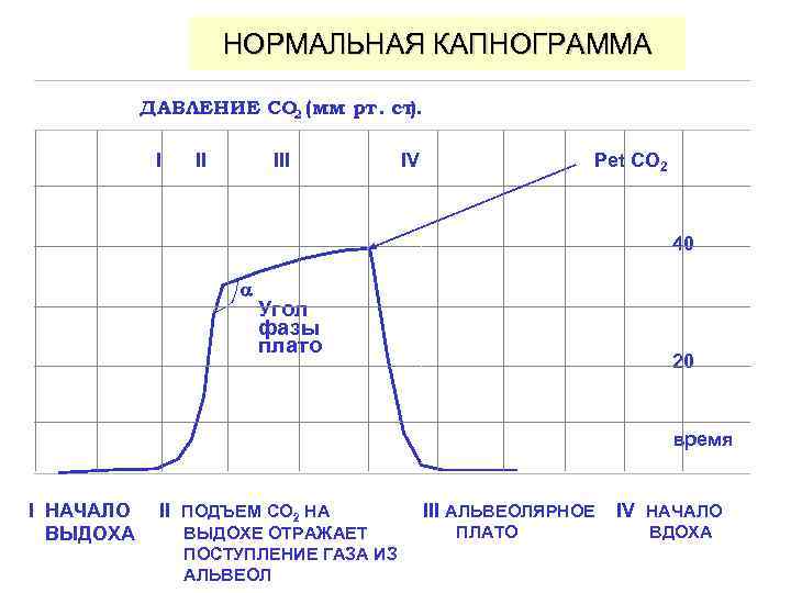 НОРМАЛЬНАЯ КАПНОГРАММА ДАВЛЕНИЕ CO 2 (мм рт. ст. ) I II IV Pet CO