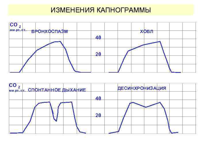 ИЗМЕНЕНИЯ КАПНОГРАММЫ CO 2 мм рт. ст. БРОНХОСПАЗМ ХОБЛ 40 20 CO 2 мм
