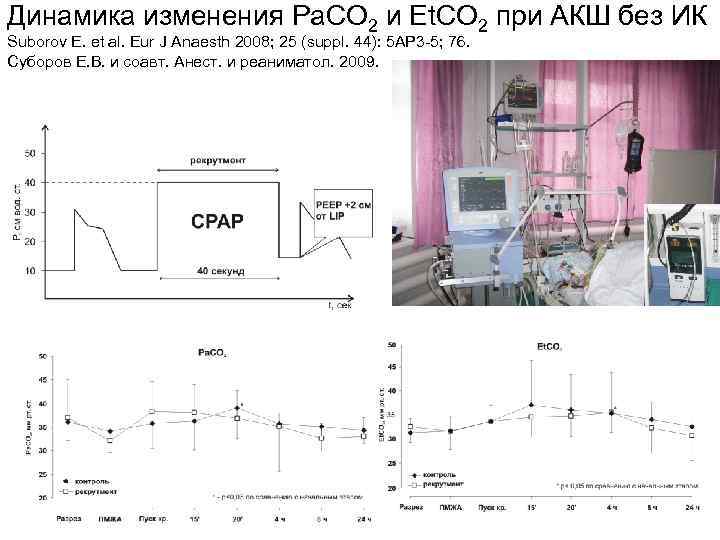 Динамика изменения Pa. CO 2 и Et. CO 2 при АКШ без ИК Suborov