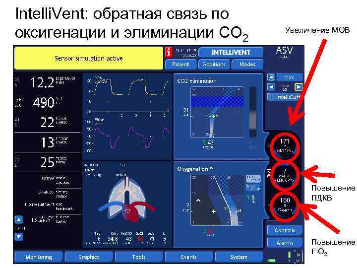 Intelli. Vent: обратная связь по оксигенации и элиминации CO 2 Увеличение МОВ Повышение ПДКВ