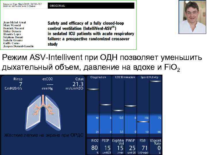 Режим ASV-Intellivent при ОДН позволяет уменьшить дыхательный объем, давление на вдохе и Fi. O