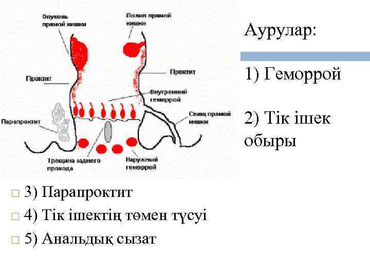 Аурулар: 1) Геморрой 2) Тік ішек обыры 3) Парапроктит 4) Тік ішектің төмен түсуі