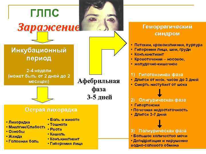  ГЛПС Заражение Инкубационный период 2 -4 недели (может быть от 2 дней дo