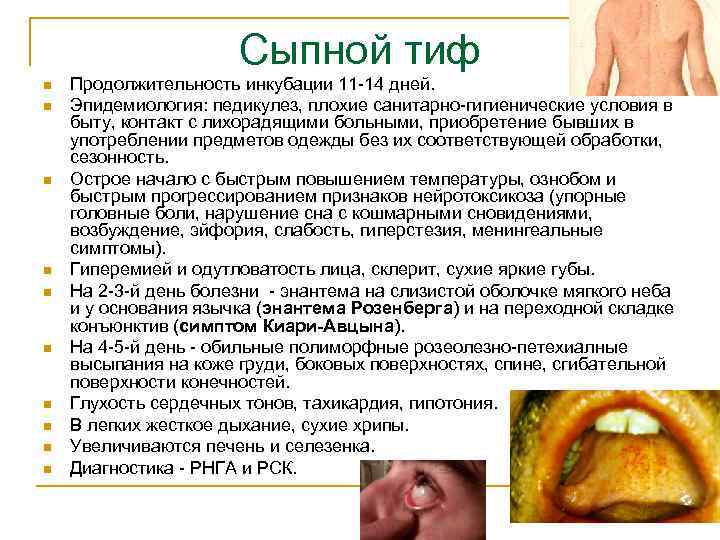 Сыпной тиф n n n n n Продолжительность инкубации 11 -14 дней. Эпидемиология: педикулез,