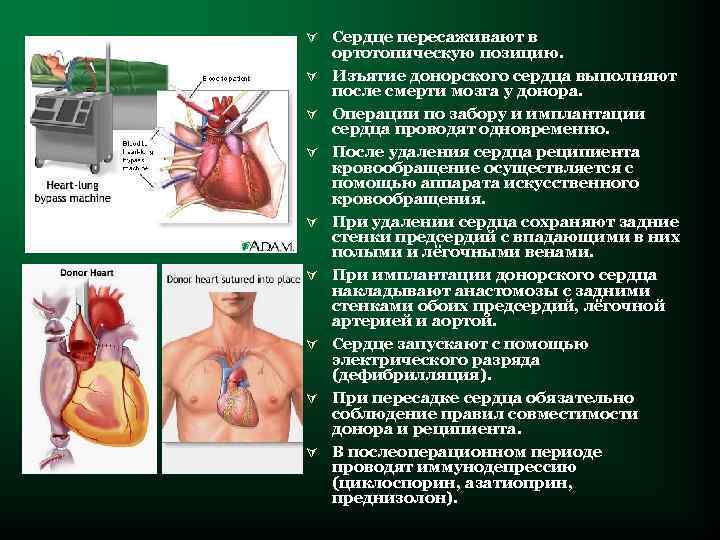 Ú Сердце пересаживают в Ú Ú Ú Ú ортотопическую позицию. Изъятие донорского сердца выполняют