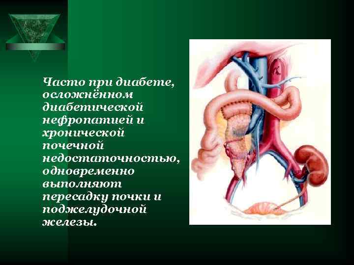 Часто при диабете, осложнённом диабетической нефропатией и хронической почечной недостаточностью, одновременно выполняют пересадку почки