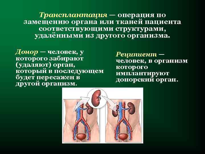 Трансплантация — операция по замещению органа или тканей пациента соответствующими структурами, удалёнными из другого