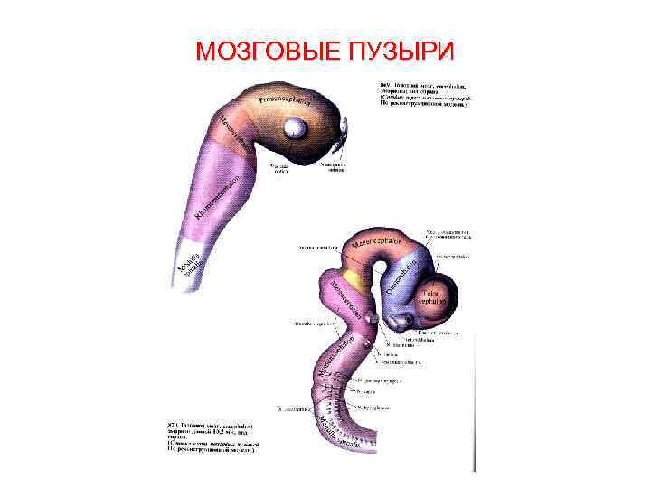 МОЗГОВЫЕ ПУЗЫРИ 