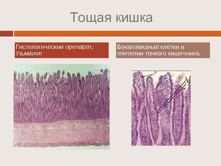 Тощая кишка Гистологический препарат. Ув. малое Бокаловидные клетки в эпителии тонкого кишечника. 