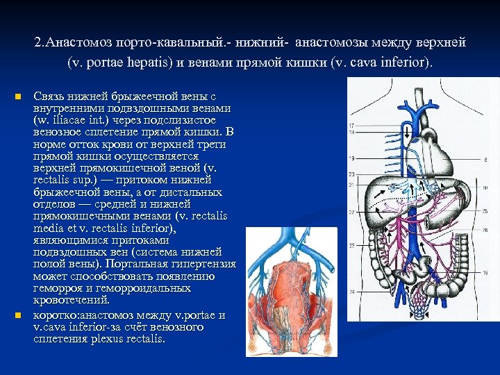 Воротная вена печени фото