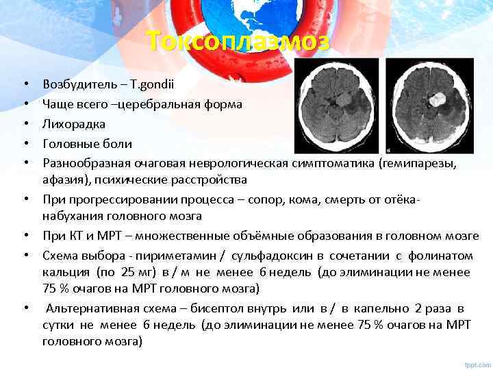 Токсоплазмоз • • • Возбудитель – Т. gondii Чаще всего –церебральная форма Лихорадка Головные