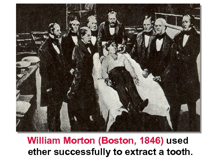 William Morton (Boston, 1846) used ether successfully to extract a tooth. 